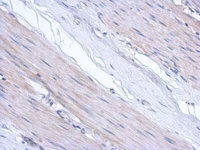 Immunohistochemistry-Paraffin: ABCF3 Antibody [NBP2-15227]