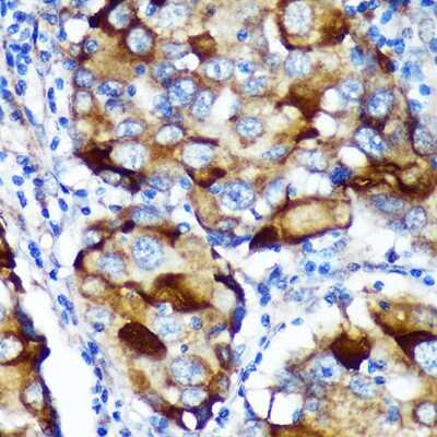 Immunohistochemistry-Paraffin: ABCF3 Antibody - Azide and BSA Free [NBP2-92211]