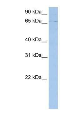 Western Blot: ABCF3 Antibody [NBP1-59381]