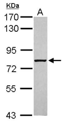 Western Blot: ABCF3 Antibody [NBP2-15227]