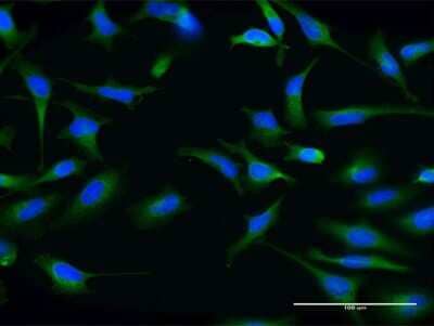 Immunocytochemistry/ Immunofluorescence: ABCG1 Antibody (2H8) [H00009619-M03]