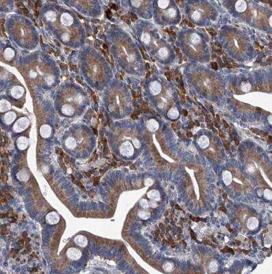 Immunohistochemistry-Paraffin: ABCG1 Antibody [NBP2-54682]