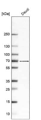 Western Blot: ABCG1 Antibody [NBP2-54682]