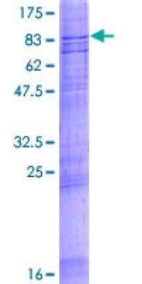 SDS-PAGE: Recombinant Human ABCG2/CD338 GST (N-Term) Protein [H00009429-P01]