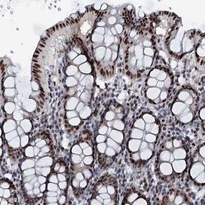 Immunohistochemistry-Paraffin: ABCG4 Antibody [NBP2-14252]