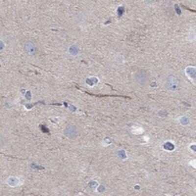 Immunohistochemistry-Paraffin: ABCG4 Antibody [NBP3-17072]