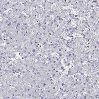 Immunohistochemistry-Paraffin: ABCG4 Antibody [NBP3-17072]