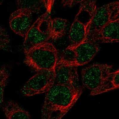 Immunocytochemistry/ Immunofluorescence: ABCG5 Antibody [NBP1-80712]