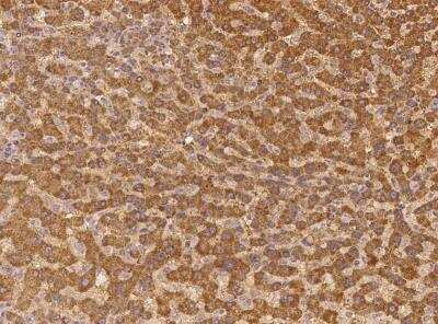 Immunohistochemistry-Paraffin: ABCG5 Antibody [NBP3-06128]