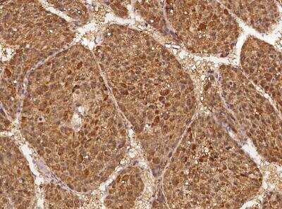 Immunohistochemistry-Paraffin: ABCG5 Antibody [NBP3-06128]