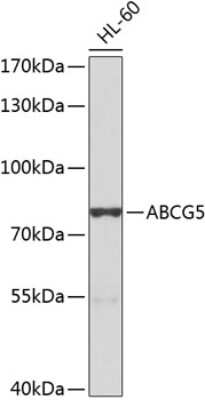 Western Blot: ABCG5 AntibodyBSA Free [NBP2-92564]