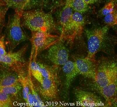 Immunocytochemistry/ Immunofluorescence: ABCG8 Antibody (1B10A5) - Azide and BSA Free [NBP2-80560]
