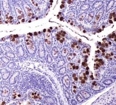 Immunohistochemistry: ABCG8 Antibody (1B10A5) [NBP1-71706]