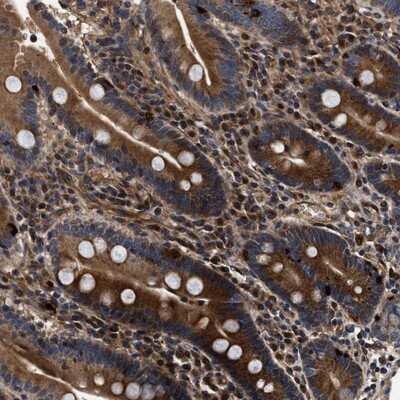 Immunohistochemistry-Paraffin: ABCG8 Antibody [NBP1-83388]