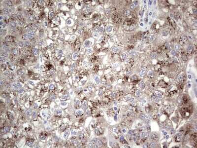 Immunohistochemistry: ABH1 Antibody (OTI4C4) [NBP2-46511]