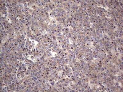 Immunohistochemistry: ABH1 Antibody (OTI4C4) [NBP2-46511]