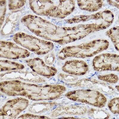 Immunohistochemistry-Paraffin: ABH1 Antibody (5K4W5) [NBP3-16787]