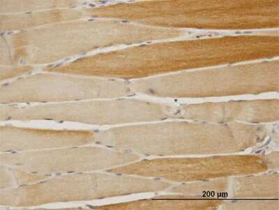Immunohistochemistry-Paraffin: ABH1 Antibody [H00008846-B01P]