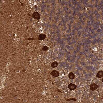 Immunohistochemistry-Paraffin: ABH1 Antibody [NBP2-14283]