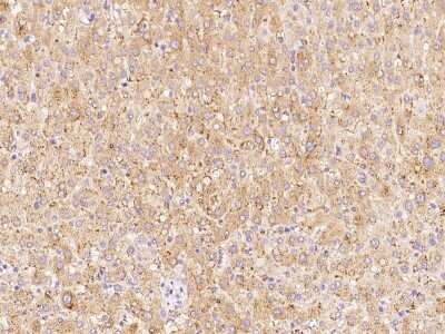 Immunohistochemistry-Paraffin: ABH1 Antibody [NBP2-98658]