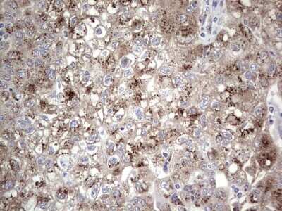 Immunohistochemistry: ABH1 Antibody (OTI4C4) - Azide and BSA Free [NBP2-71390]