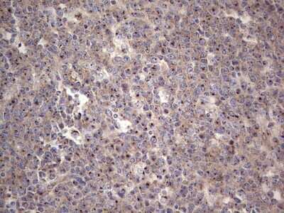 Immunohistochemistry: ABH1 Antibody (OTI4C4) - Azide and BSA Free [NBP2-71390]