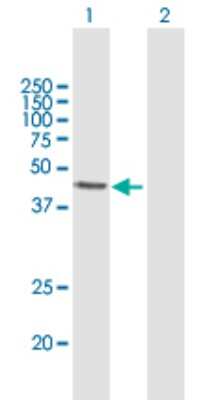 Western Blot: ABH1 Antibody [H00008846-B01P]