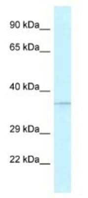 Western Blot: ABH1 Antibody [NBP1-79909]