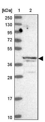 Western Blot: ABH1 Antibody [NBP2-14283]