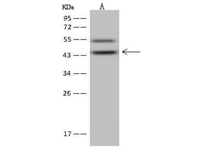 Western Blot: ABH1 Antibody [NBP2-98658]