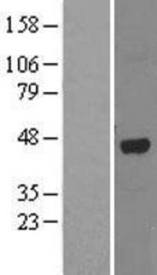 Western Blot: ABH1 Overexpression Lysate [NBL1-07472]