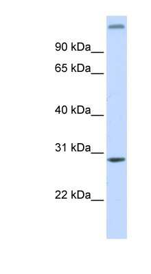 Western Blot: ABH2 Antibody [NBP1-56921]