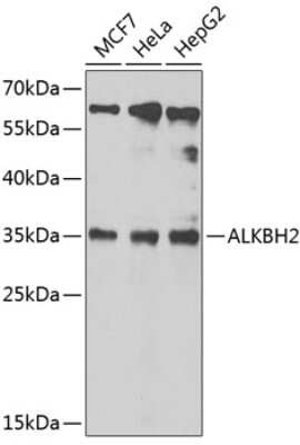 Western Blot: ABH2 AntibodyBSA Free [NBP2-92472]