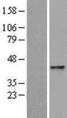 Western Blot: ABH2 Overexpression Lysate [NBL1-07473]