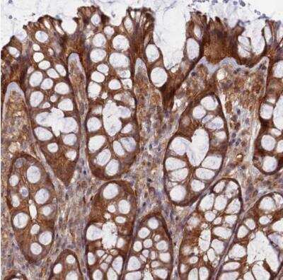 Immunohistochemistry-Paraffin: ABHD1 Antibody [NBP1-91644]