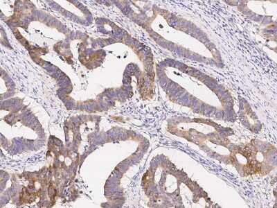 Immunohistochemistry-Paraffin: ABHD1 Antibody [NBP2-99171]