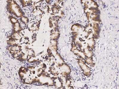 Immunohistochemistry-Paraffin: ABHD1 Antibody [NBP2-99171]