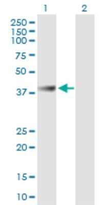 Western Blot: ABHD1 Antibody [H00084696-B01P]