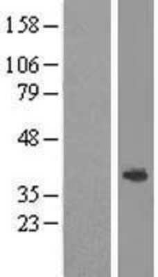 Western Blot: ABHD1 Overexpression Lysate [NBP2-05988]