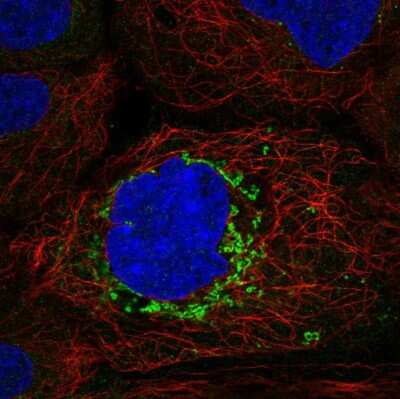 Immunocytochemistry/ Immunofluorescence: ABHD10 Antibody [NBP2-57747]