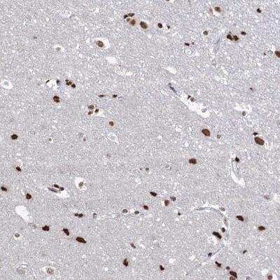 Immunohistochemistry: ABHD10 Antibody [NBP2-32679]