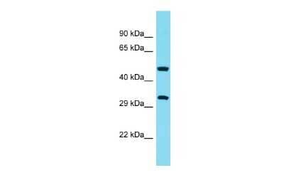 Western Blot: ABHD10 Antibody [NBP2-86936]