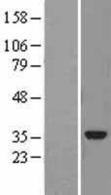 Western Blot: ABHD10 Overexpression Lysate [NBL1-07189]