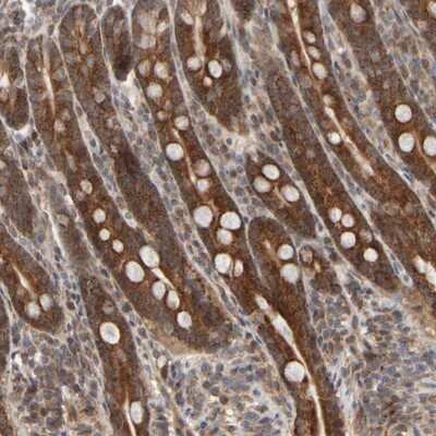 Immunohistochemistry-Paraffin: ABHD11 Antibody [NBP1-87254]