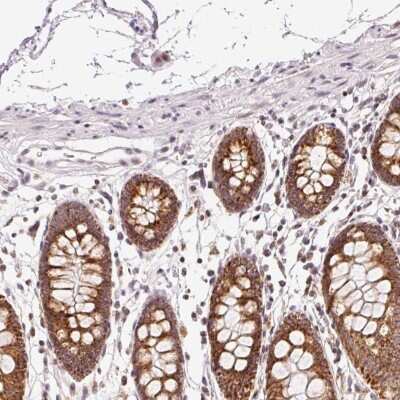 Immunohistochemistry-Paraffin: ABHD11 Antibody [NBP2-33574]
