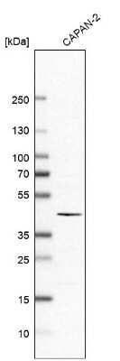 Western Blot: ABHD11 Antibody [NBP1-87254]