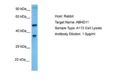 Western Blot: ABHD11 Antibody [NBP2-86939]