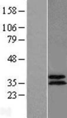 Western Blot: ABHD11 Overexpression Lysate [NBL1-07190]