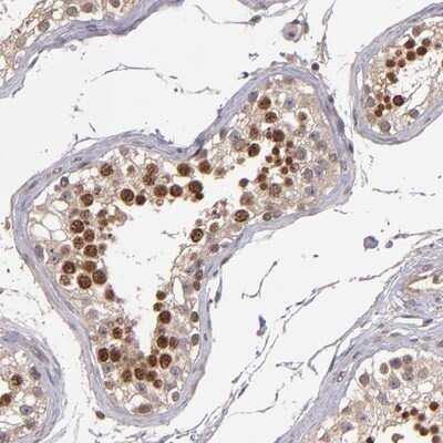 Immunohistochemistry-Paraffin: ABHD12B Antibody [NBP1-88669]