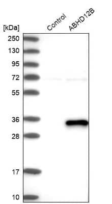 Western Blot: ABHD12B Antibody [NBP1-88669]